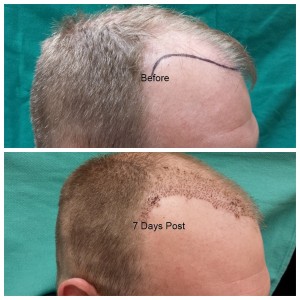 Before and Post 7 Days